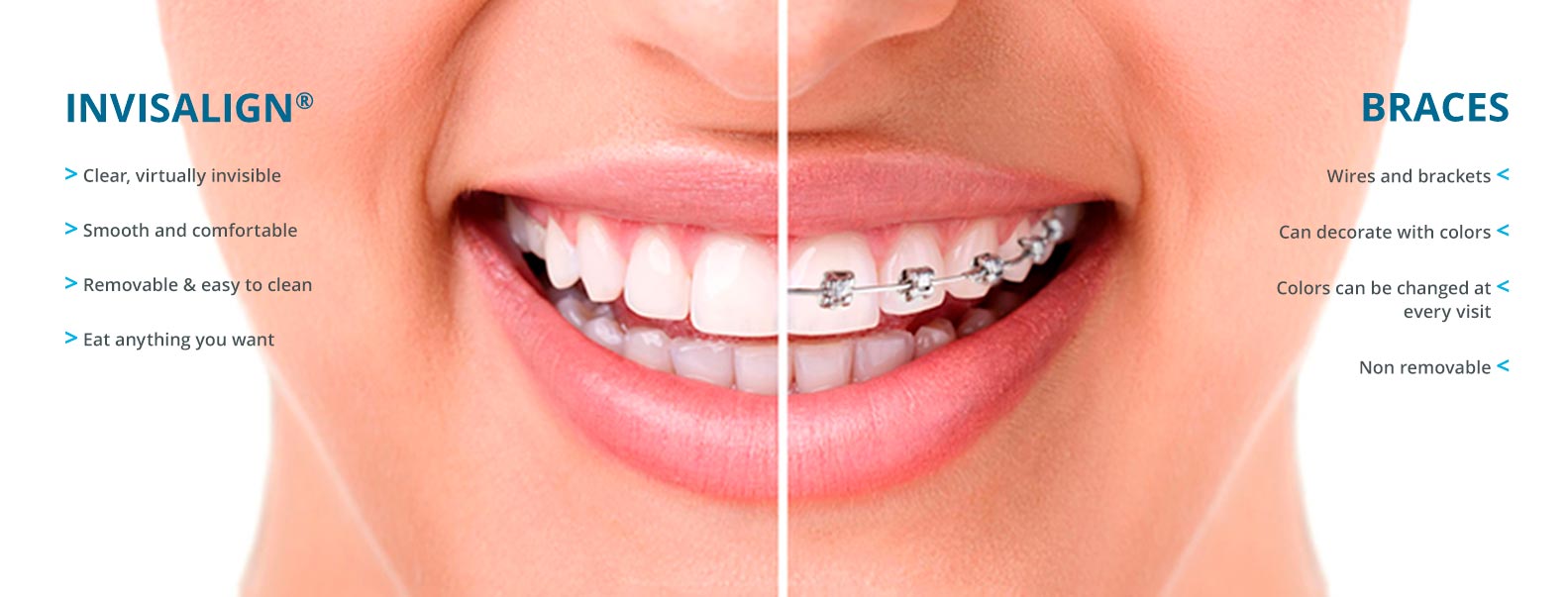 Orthodontist Cibolo TX Invisalign Braces Embrace Orthodontics